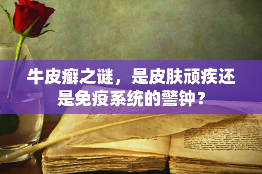 牛皮癣之谜，是皮肤顽疾还是免疫系统的警钟？