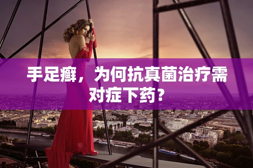 手足癣，为何抗真菌治疗需对症下药？