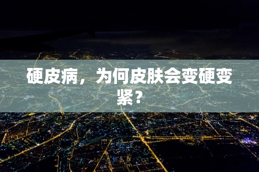 硬皮病，为何皮肤会变硬变紧？