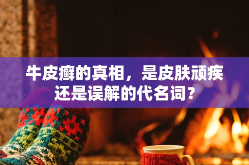 牛皮癣的真相，是皮肤顽疾还是误解的代名词？